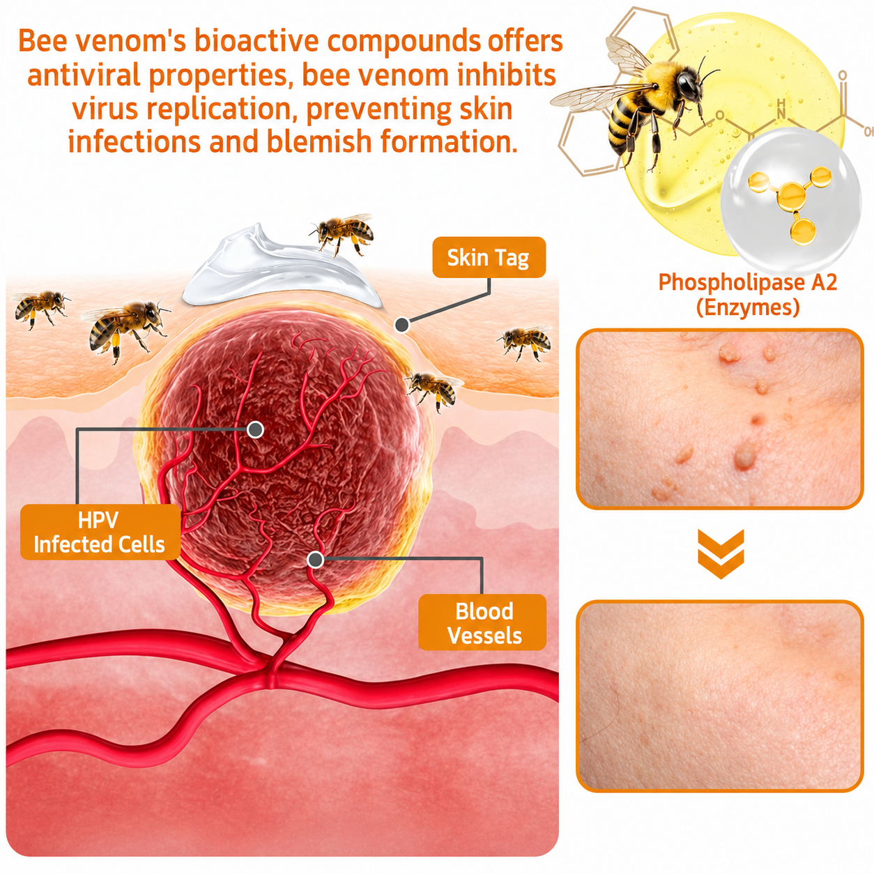 🔥Rolimey® Bee Venom Skin Treatment Cream