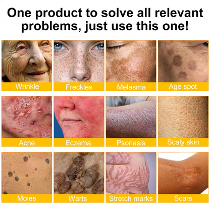 ❤️Over 100,000 Jars Sold 🔥— Rolimey® Bee Venom Skin Restoration Cream