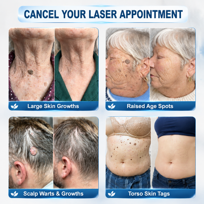 ❤️𝐎𝐟𝐟𝐢𝐜𝐢𝐚𝐥 𝐒𝐭𝐨𝐫𝐞 | GFOUK®  👩‍⚕️𝐁𝐨𝐭𝐚𝐧𝐢𝐜𝐚𝐥 𝐌𝐢𝐜𝐫𝐨𝐧𝐞𝐞𝐝𝐥𝐞 𝐇𝐲𝐝𝐫𝐨𝐜𝐨𝐥𝐥𝐨𝐢𝐝 𝐏𝐚𝐭𝐜𝐡 (𝐅𝐨𝐫 𝐒𝐤𝐢𝐧 𝐓𝐚𝐠𝐬, 𝐒𝐦𝐚𝐥𝐥 𝐒𝐤𝐢𝐧 𝐆𝐫𝐨𝐰𝐭𝐡𝐬, 𝐖𝐚𝐫𝐭𝐬, 𝐌𝐨𝐥𝐞𝐬, 𝐀𝐠𝐞 𝐒𝐩𝐨𝐭𝐬 & 𝐏𝐢𝐠𝐦𝐞𝐧𝐭𝐚𝐭𝐢𝐨𝐧 𝐂𝐨𝐧𝐜𝐞𝐫𝐧𝐬)
