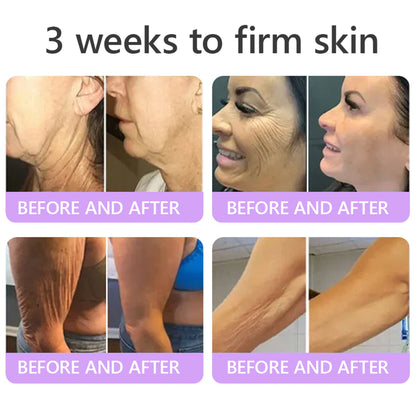 💜ROLIMEY® 𝐏𝐃𝐑𝐍 𝐌𝐮𝐥𝐭𝐢-𝐏𝐞𝐩𝐭𝐢𝐝𝐞 𝐌𝐚𝐬𝐬𝐚𝐠𝐢𝐧𝐠 𝐁𝐨𝐝𝐲 𝐑𝐨𝐥𝐥𝐞𝐫 𝐂𝐫𝐞𝐚𝐦- 𝐀𝐧𝐭𝐢-𝐚𝐠𝐢𝐧𝐠, 𝐇𝐲𝐝𝐫𝐚𝐭𝐢𝐧𝐠, 𝐒𝐤𝐢𝐧 𝐅𝐢𝐫𝐦𝐢𝐧𝐠 & 𝐋𝐢𝐟𝐭𝐢𝐧𝐠, 𝐒𝐤𝐢𝐧 𝐑𝐞𝐩𝐚𝐢𝐫, 𝐄𝐯𝐞𝐧 𝐓𝐨𝐧𝐞, 𝐀𝐜𝐧𝐞 𝐚𝐧𝐝 𝐃𝐚𝐫𝐤 𝐒𝐩𝐨𝐭 𝐓𝐫𝐞𝐚𝐭𝐦𝐞𝐧𝐭, 𝐖𝐚𝐫𝐭 𝐚𝐧𝐝 𝐌𝐨𝐥𝐞 𝐑𝐞𝐦𝐨𝐯𝐚𝐥, 𝐚𝐧𝐝 𝐏𝐬𝐨𝐫𝐢𝐚𝐬𝐢𝐬 𝐑𝐞𝐥𝐢𝐞𝐟.