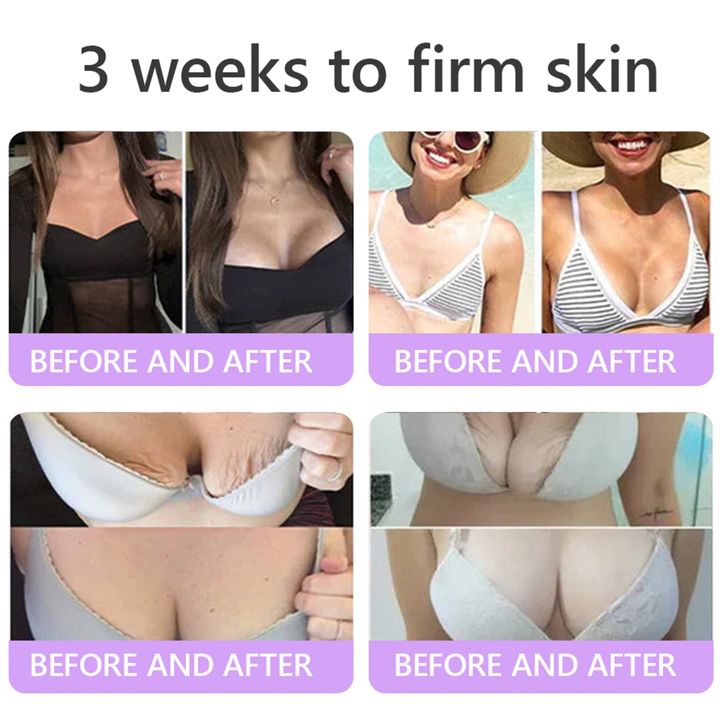 💜ROLIMEY® 𝐏𝐃𝐑𝐍 𝐌𝐮𝐥𝐭𝐢-𝐏𝐞𝐩𝐭𝐢𝐝𝐞 𝐌𝐚𝐬𝐬𝐚𝐠𝐢𝐧𝐠 𝐁𝐨𝐝𝐲 𝐑𝐨𝐥𝐥𝐞𝐫 𝐂𝐫𝐞𝐚𝐦- 𝐀𝐧𝐭𝐢-𝐚𝐠𝐢𝐧𝐠, 𝐇𝐲𝐝𝐫𝐚𝐭𝐢𝐧𝐠, 𝐒𝐤𝐢𝐧 𝐅𝐢𝐫𝐦𝐢𝐧𝐠 & 𝐋𝐢𝐟𝐭𝐢𝐧𝐠, 𝐒𝐤𝐢𝐧 𝐑𝐞𝐩𝐚𝐢𝐫, 𝐄𝐯𝐞𝐧 𝐓𝐨𝐧𝐞, 𝐀𝐜𝐧𝐞 𝐚𝐧𝐝 𝐃𝐚𝐫𝐤 𝐒𝐩𝐨𝐭 𝐓𝐫𝐞𝐚𝐭𝐦𝐞𝐧𝐭, 𝐖𝐚𝐫𝐭 𝐚𝐧𝐝 𝐌𝐨𝐥𝐞 𝐑𝐞𝐦𝐨𝐯𝐚𝐥, 𝐚𝐧𝐝 𝐏𝐬𝐨𝐫𝐢𝐚𝐬𝐢𝐬 𝐑𝐞𝐥𝐢𝐞𝐟.