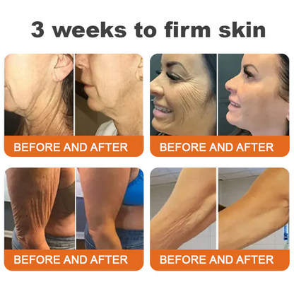 ❤️Over 100,000 Jars Sold 🔥— Rolimey® Bee Venom Skin Restoration Cream