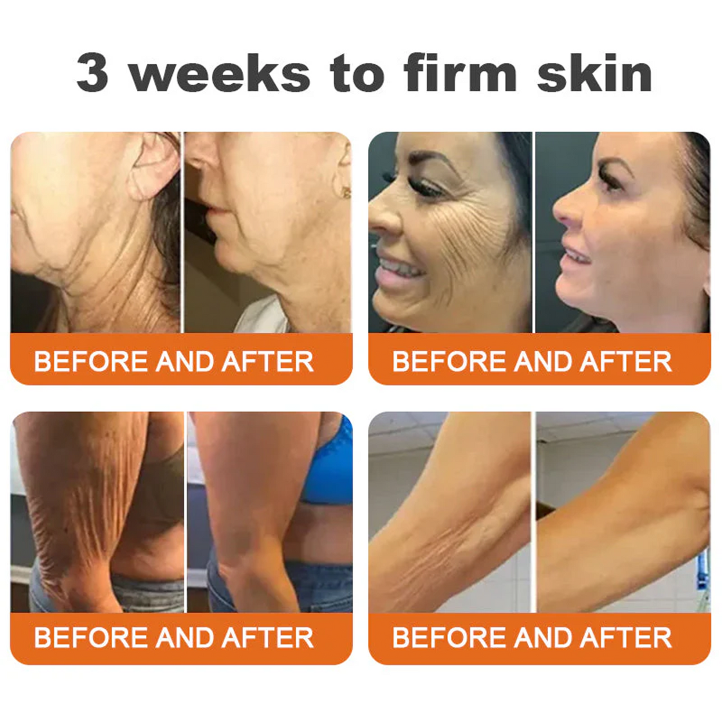 🌟❤️ Rolimey® Bee venom Pro Comprehensive Cream —Tightening for Skin Types 🔥